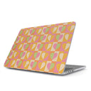 Summer Love - Macbook Case