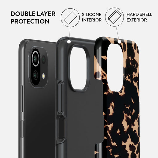 Betty - Xiaomi 11 Lite 5G NE Case 2