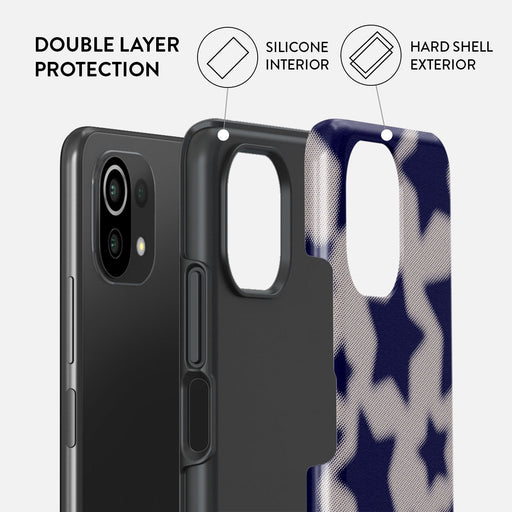 Starstruck - Xiaomi 11 Lite 5G NE Case 2
