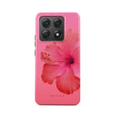 Island Girl -Xiaomi 14T Case 1