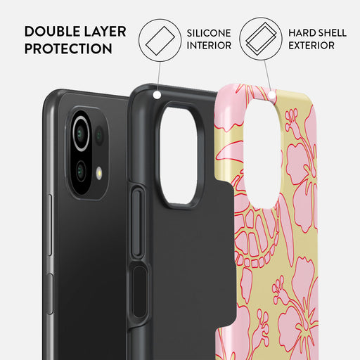 Tan Break - Xiaomi Mi 11 Lite 4G / 5G Case 2