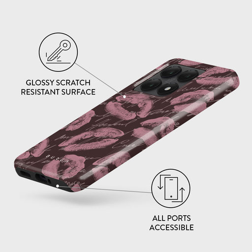 Melodrama - Xiaomi 14T Case 3