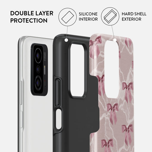Ballerina - Xiaomi 11T / 11T Pro Case 2