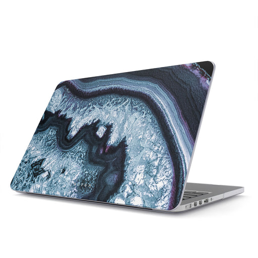 Frozen Lake - Macbook Case 1
