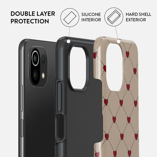 Love Letter - Xiaomi 11 Lite 5G NE Case 2